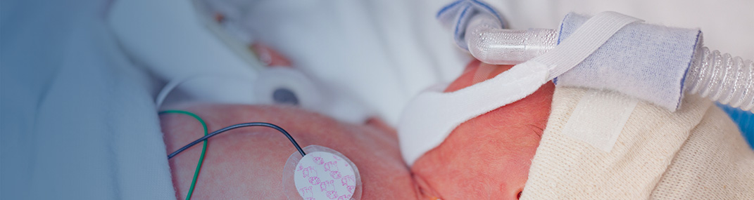 Infant Apnea Hero
