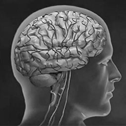 Stroke Symptoms
