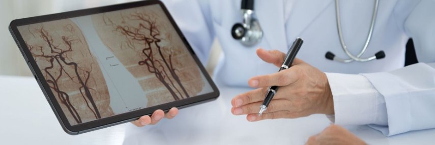 Vascular Surgery Hero