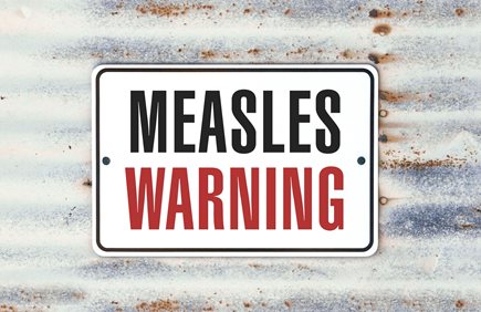 How to Prevent Measles