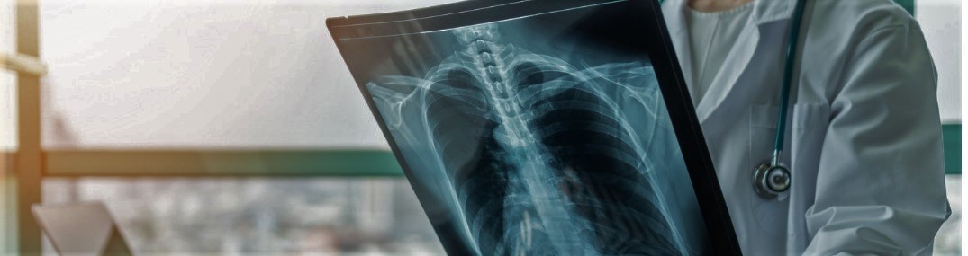 Lung Cancer Screening Hero